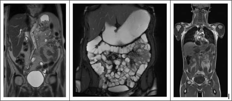 Imagerie abdomen et oncologie