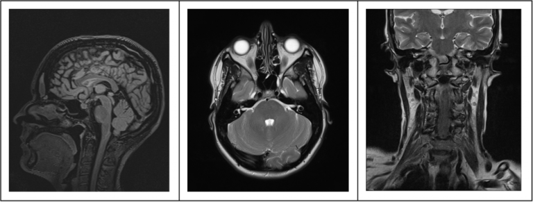 Imagerie ORL et neurologique