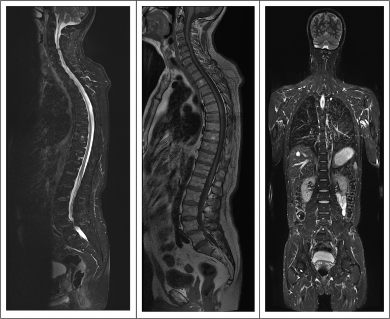 Imagerie rhumatologie